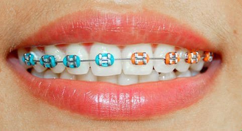 Dental Care AF.REZA (TUKANG GIGI) di Tugu