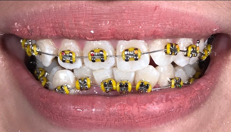 Klinik dokter gigi surabaya timur - crown dental solution semolowaru di Sukolilo