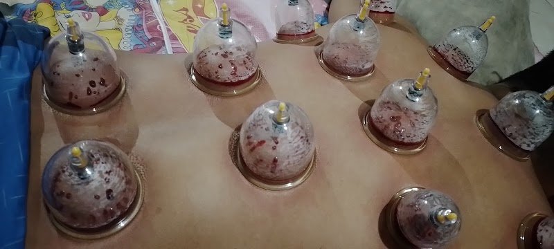 Pijat urat H Rifai di Simokerto